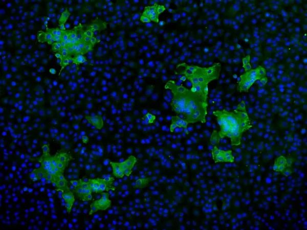 明美荧光显微镜应战新型冠状病毒疫情