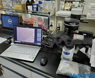 明美新款显微镜相机助力深圳市第三人民医院肝病研究所活细胞检测
