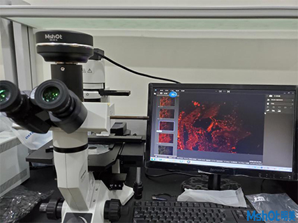 明美显微镜相机力香港大学深圳医院荧光组织切片观察
