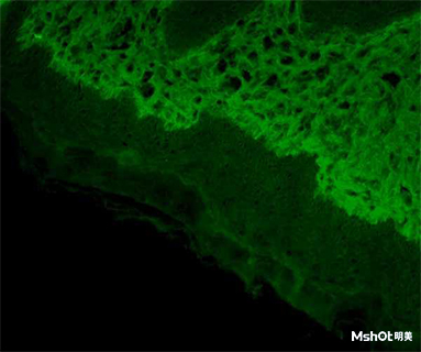 倒置荧光显微镜镜应用于皮肤组织观察