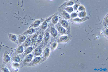 倒置显微镜应用于细胞株培养