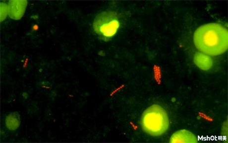 荧光显微镜应用于妇科真菌检测