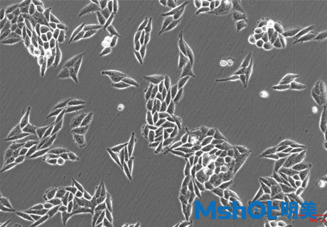 倒置显微镜MI52-N搭配显微镜MD60拍摄的乳腺癌细胞