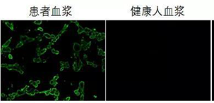 间接免疫荧光