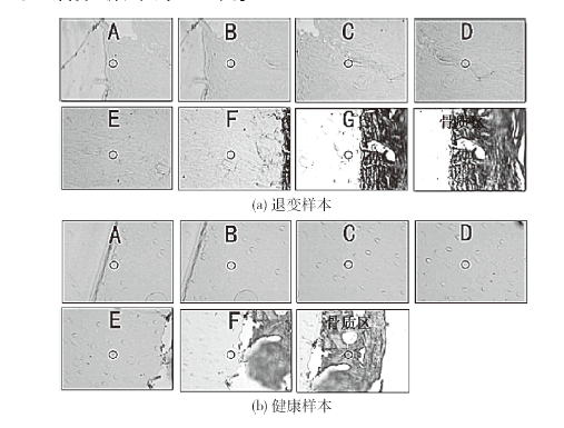 显微荧光光谱分析软骨退变 