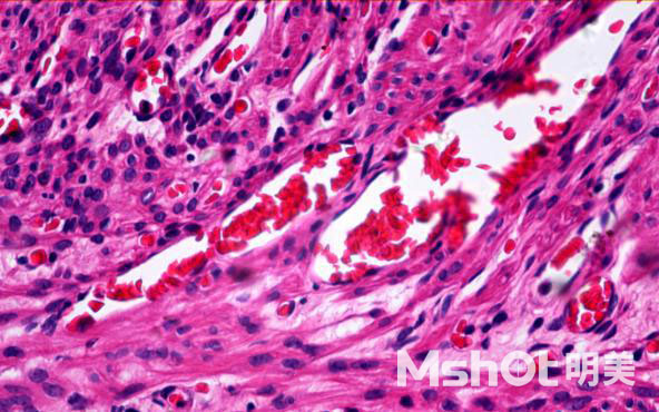 明美高端荧光成像装置MF41+MS31走进汕头大学