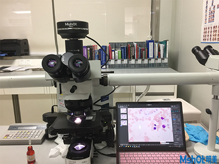 明美科研级摄像头助力香港大学深圳医院血液科骨髓切片观察