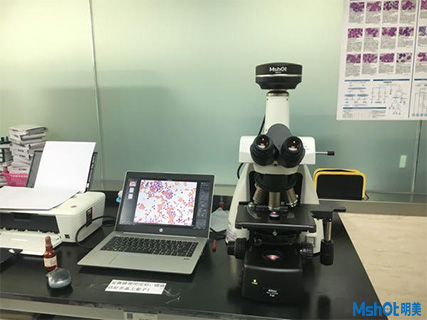 明美倒置荧光显微镜应用于骨髓观察
