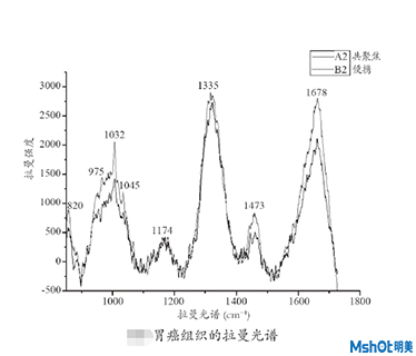 拉曼光谱技术在生物医学中的应用
