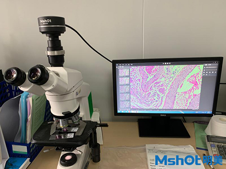 明美高分辨率显微镜相机助力病理切片检验