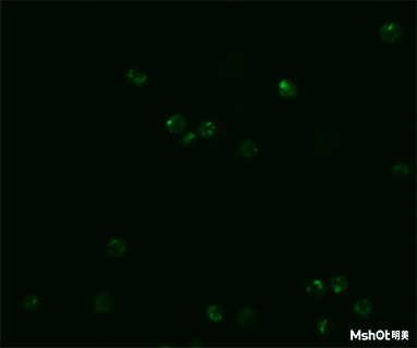 明美倒置荧光显微镜助力中国科学技术大学溶酶体观察