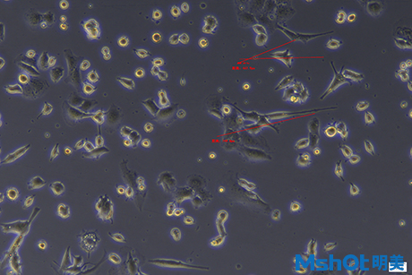 倒置显微镜下的细胞培养