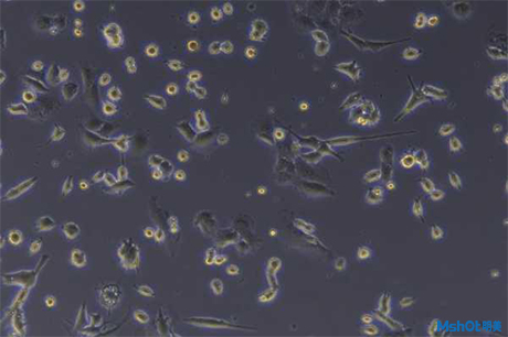 倒置显微镜应用于小鼠细胞株观察