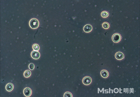 倒置显微镜下观察的酵母