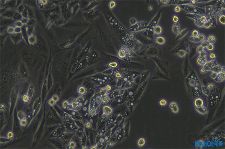 倒置显微镜下的活细胞