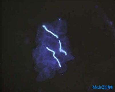 明美荧光显微镜应用于真菌检测