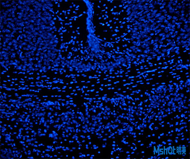 明美多波段LED光源用于尼康倒置荧光显微镜TI2荧光观察