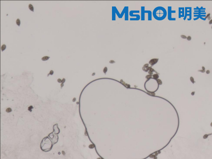 不同显微镜下的真菌孢子