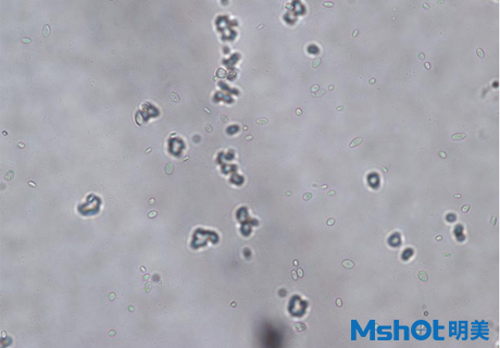 国产生物显微镜搭配显微镜相机观察到乳酸菌