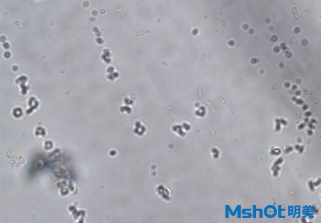 国产生物显微镜搭配显微镜相机观察到乳酸菌
