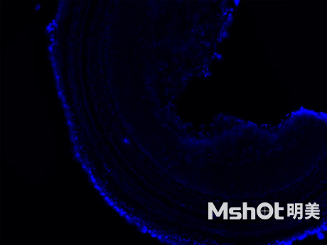 倒置荧光显微镜应用于小鼠耳蜗观察
