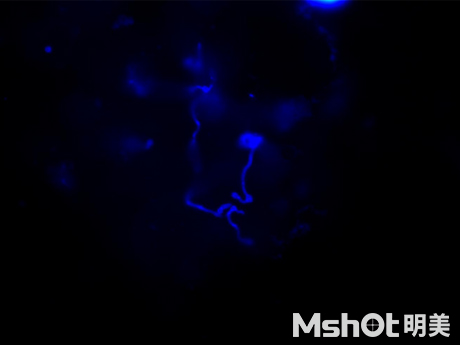 荧光生物显微镜应用于医院皮肤真菌检查
