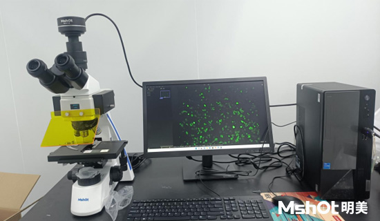 荧光生物显微镜MF31-M应用于体外荧光诊断