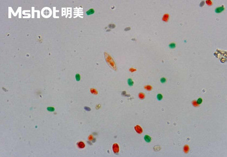 生物显微镜ML51-M观察染色酵母菌