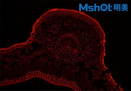 生物显微镜ML51-M观察染色酵母菌