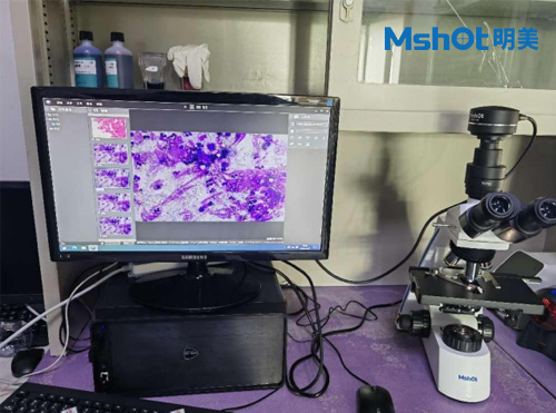 国产生物显微镜用于观察中性粒细胞