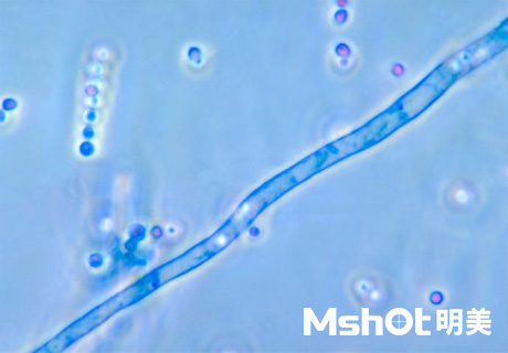 国产显微镜应用于烟曲霉检测