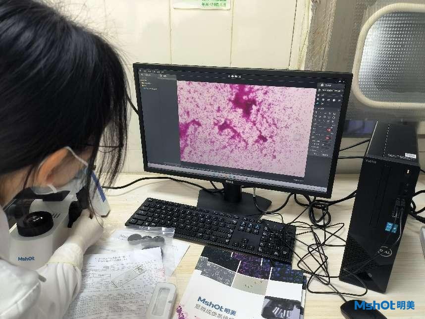 生物显微镜应用于肝细胞观察|应用百科