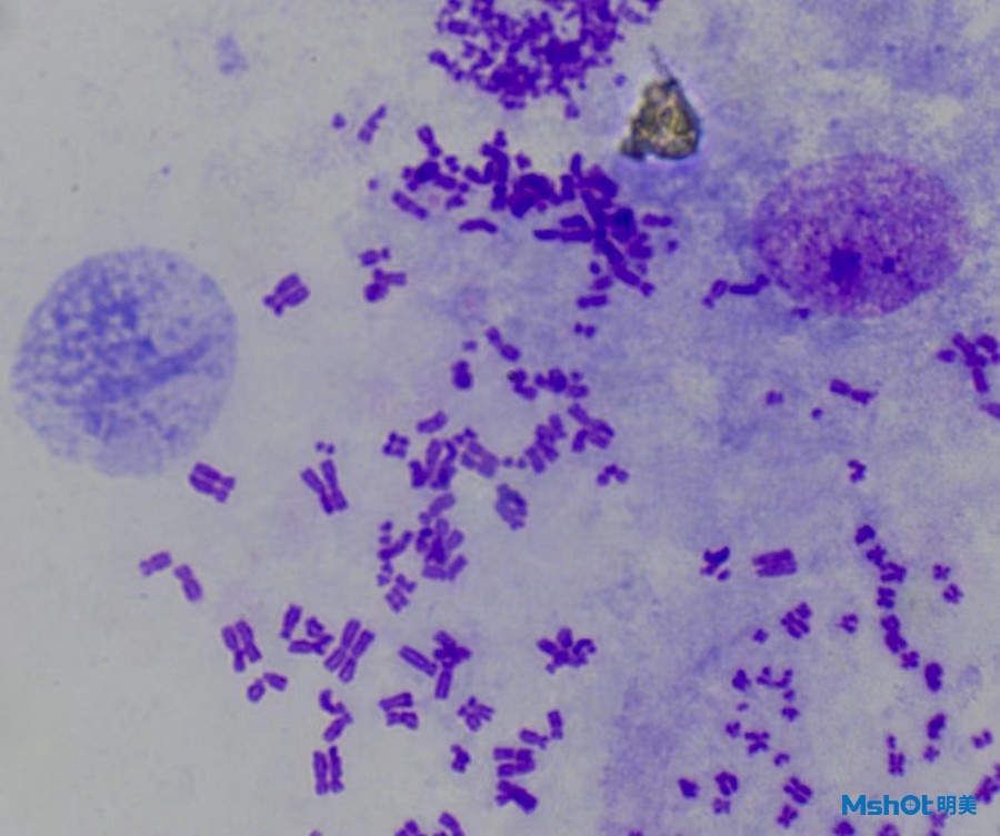 不同显微镜应用染色体|应用百科