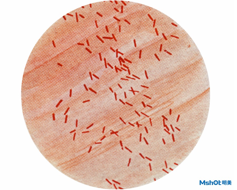 科普小知识-大肠杆菌可能也是益生菌？|应用百科