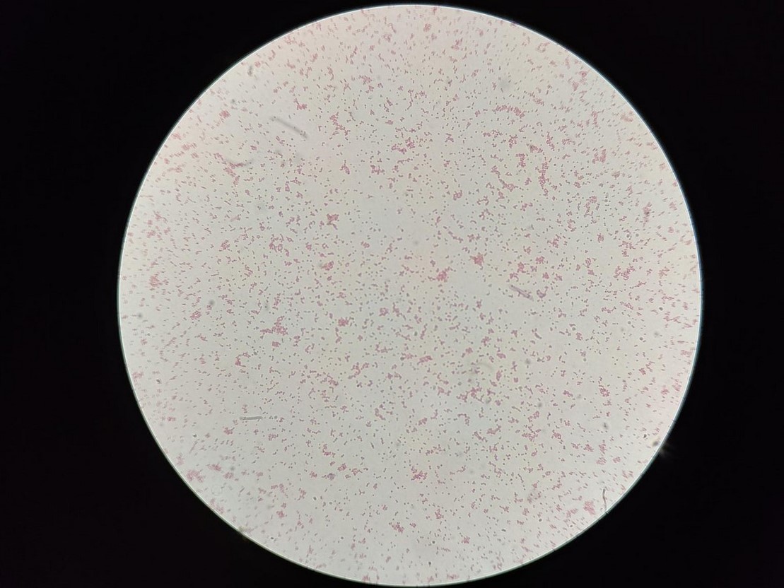 显微镜下的球菌和短杆菌|应用百科