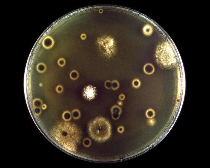 荧光显微镜下的新生隐球菌|应用百科