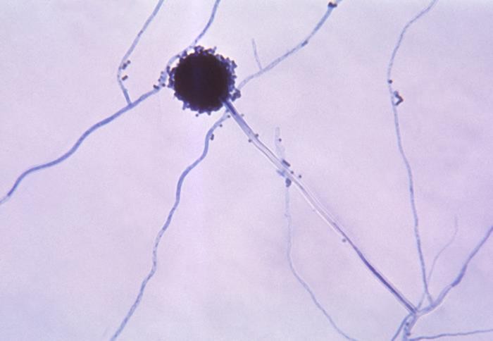 生物显微镜下的黑曲霉|应用百科