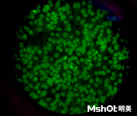 荧光生物显微镜应用于ANA-HEp2免疫荧光诊断