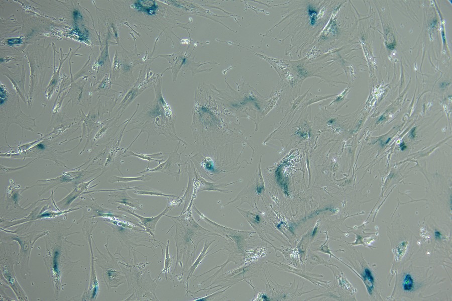 倒置显微镜应用于纤维细胞观察|应用百科
