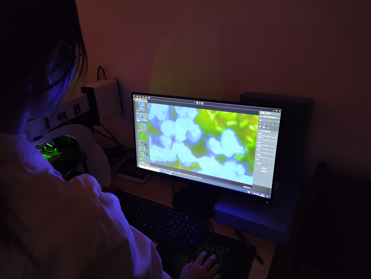荧光生物显微镜用于肿瘤标志物筛查|应用百科