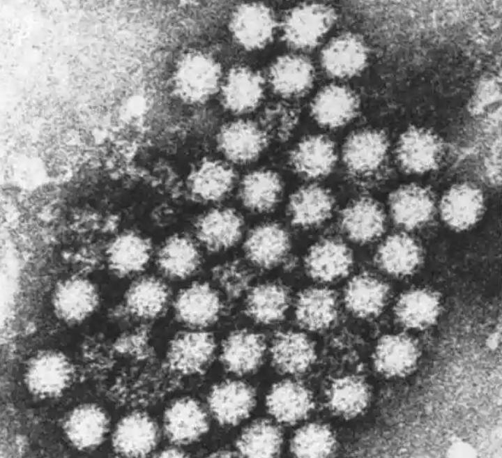 显微镜应用于诺如病毒研究|应用百科