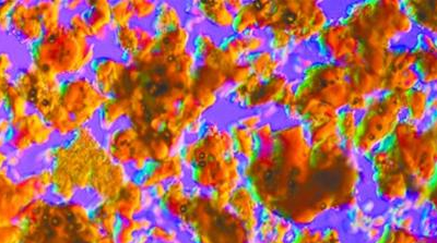 这张鲜艳夺目的照片是速溶咖啡颗粒，偏光显微镜拍摄