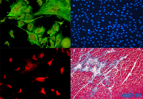 探索活细胞世界——倒置荧光显微镜MF52-N